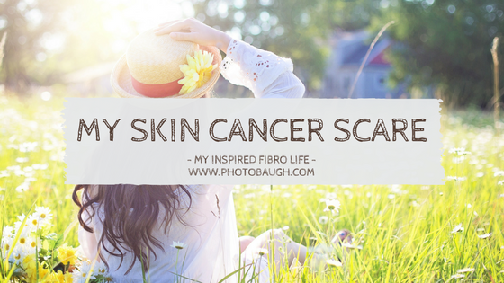 My Skin Cancer&nbsp;Scare